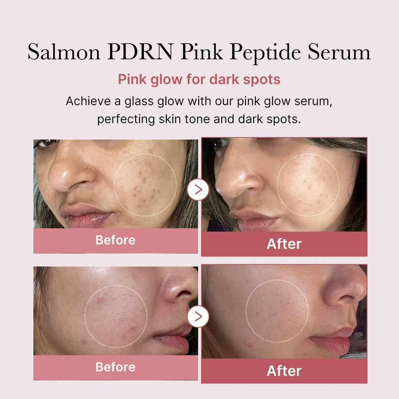 Medicube PDRN Pink Peptide Glow Serum (30 ml)